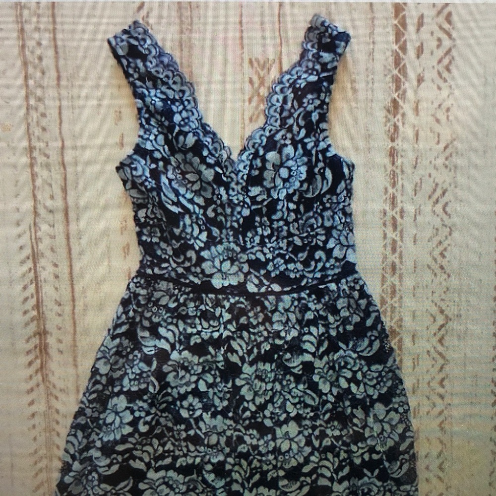 Elegant Black and White Lace Dress